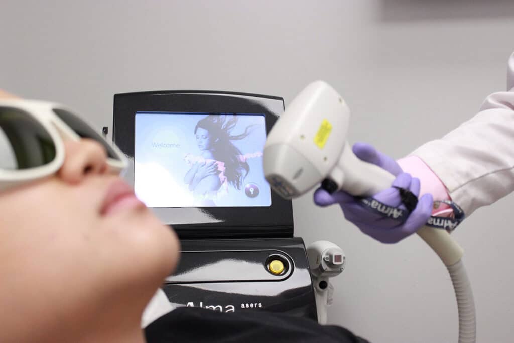Laser Hair Removal Vancouver Arion Skin Care Clinic